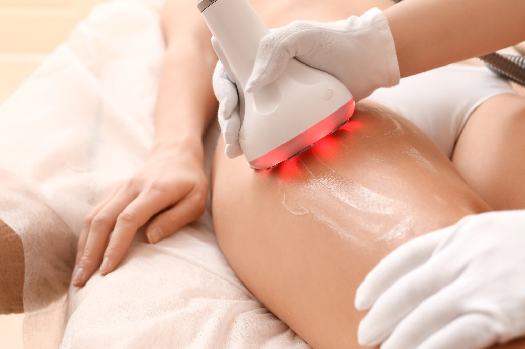 Cavitation